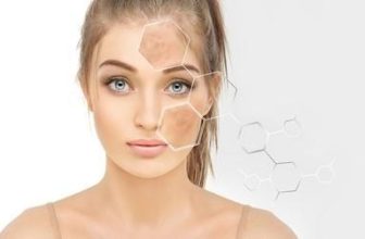 Understanding Hyperpigmentation: Causes and Treatment Options