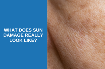 What Sun Damage Actually Looks Like