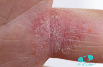 15 most common cases and their treatment