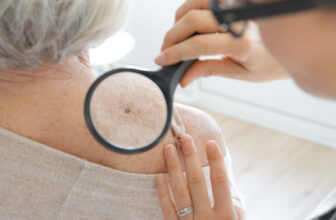 Do You Need Treatment for Every Skin Cancer Diagnosis?