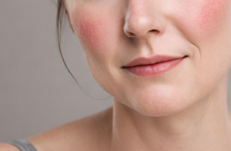 Redness? We Can Help | Pure Dermatology