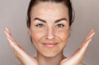 Sun Spots, Age Spots, and Liver Spots: How Do I Get Rid of Them?