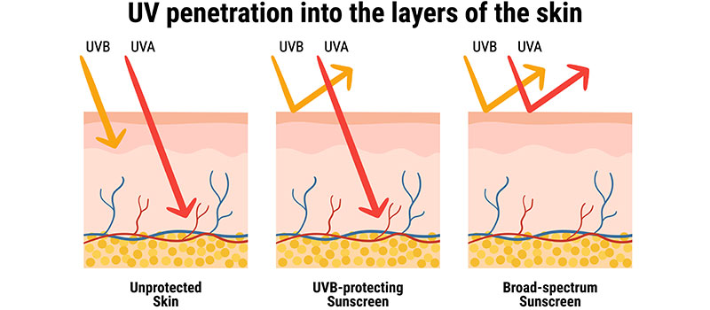 Diagram comparing UVA deep skin penetration versus UVB surface sunburn damage