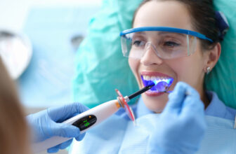 Composite Bonding: What Nobody Tells You About the Second Year
