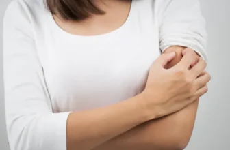 Irritant Contact Dermatitis OTC Relief