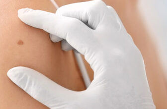 How to Prevent Melanoma | CT Dermatologist Skin Cancer Prevention