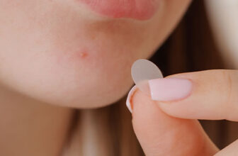 Acne Patches FAQs | Do Pimple Patches Work for Acne?