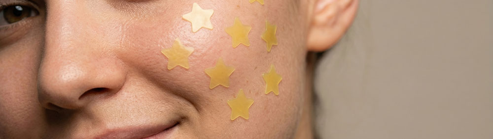 Woman wearing yellow star acne patches on her cheek