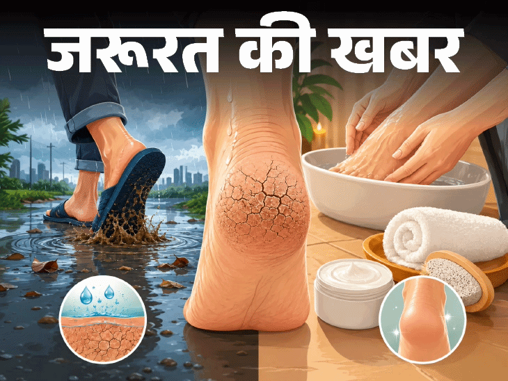 नमी, पानी, गंदगी है कारण, जानें कैसे रखें सुरक्षित, मानसून फुट केयर रूटीन के 8 स्टेप्स|लाइफस्टाइल,Lifestyle - Dainik Bhaskar