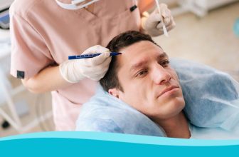 How Does Hair Transplantation Work for Restoring Hair Loss?