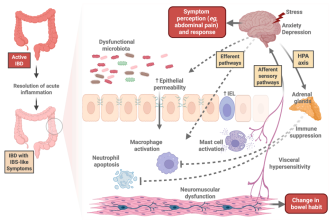 The Tricky Problem of IBD with IBS-like symptoms