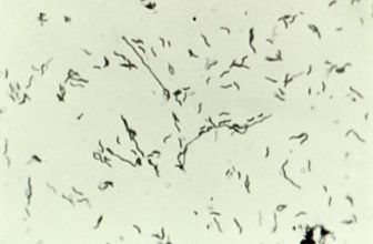 Contaminated spring water sickens wedding guests