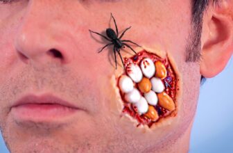 SPIDER LAYS EGGS IN FACE!