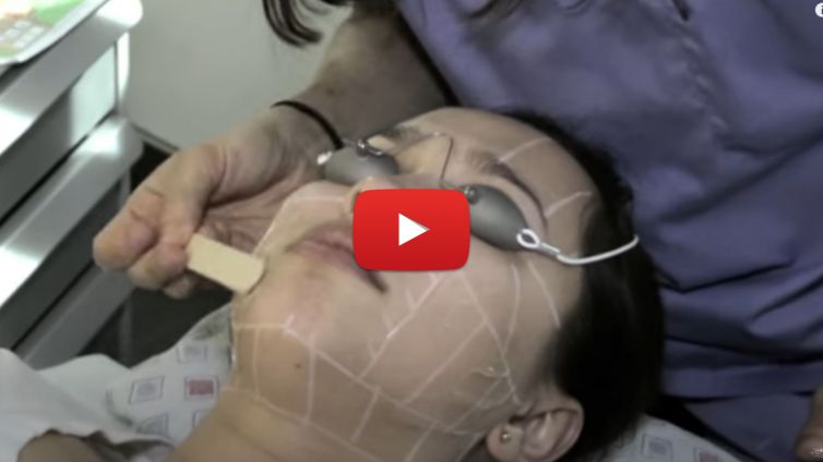 Bride’s Maid Needs Ultherapy Before Wedding!