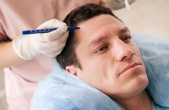 Join the Hair Force With Hair Restoration Packages
