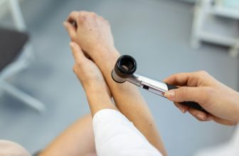 Psoriasis Care Tips for Hot, Humid St. Louis