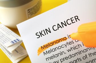 New scanning method detects basal cell carcinoma early using AI