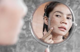 How to Fix Sun Damaged Skin