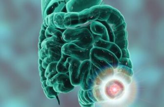Why Are More Adults Under 50 Getting Colorectal Cancer? What You Need to Know Now