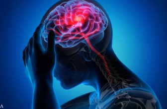 Why Strokes Are More Common in the Morning