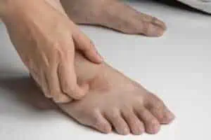 Ringworm on top of foot