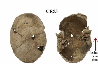 Flat Head Syndrome in 42% of Iron Age Italians