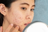 Expert Dermatologist Treatments That Work