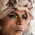 What Causes Melasma and How It’s Treated