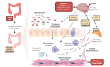 The Tricky Problem of IBD with IBS-like symptoms