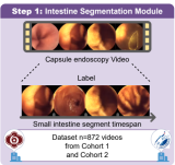 AI for Capsule Endoscopy: | gutsandgrowth