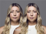 The RHA® Collection – New Dynamic Filler