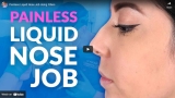 Painless Liquid Nose Job Using Fillers
