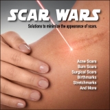 Scar Wars
