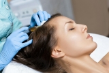 PRP Hair Restoration in St. Louis: Cost and Timeline