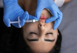 Summer Botox Tips for Safe, Natural-Looking Results