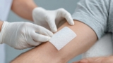 Minimize a scar: Proper wound care tips from dermatologists