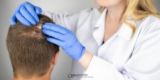 Alopecia Areata: Why Am I Losing Hair in Patches?