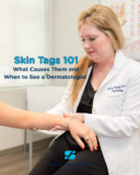 Skin Tags 101: What Causes Them and When to See a Dermatologist