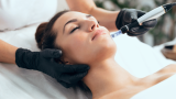 The Benefits of Microneedling for Skin Rejuvenation at Gold Skin Care Center