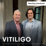 Optima Dermatology on New Day Cleveland – Vitiligo