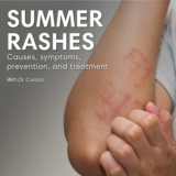 Optima Dermatology on Common Summer Rashes and How to Treat Them