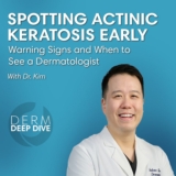 Actinic Keratosis: How to Spot It