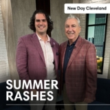Optima Dermatology on New Day Cleveland – Summer Rashes