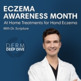 Hand Eczema Treatment | Optima Dermatology