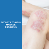 Dermatologist’s Tips for Managing Psoriasis