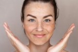 Sun Spots, Age Spots, and Liver Spots: How Do I Get Rid of Them?