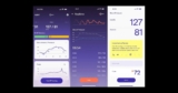 Signal Ring gives blood pressure readings, better than an Apple Watch