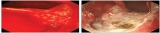 Official journal of the American College of Gastroenterology