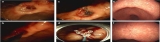 Official journal of the American College of Gastroenterology