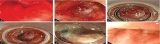 Official journal of the American College of Gastroenterology